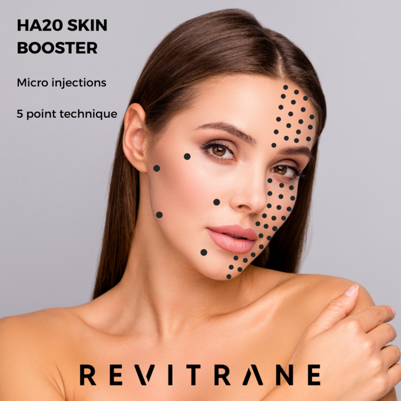 Revitrane HA20 Skin Booster treatment areas
